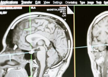 30 minutos diarios de ejercicio puede mejorar la salud de tu sistema nervioso