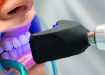 claves del blanqueamiento dental